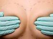 What Is Breast Enlargement?