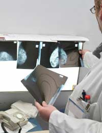 Breast Cancer breast Cancer Screening 